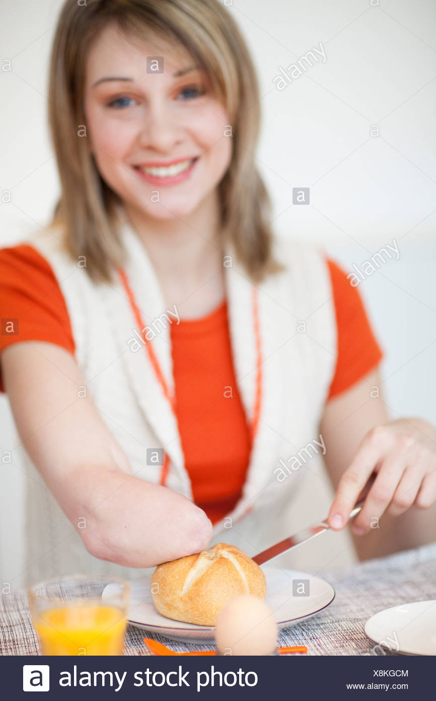 Arm amputee dating