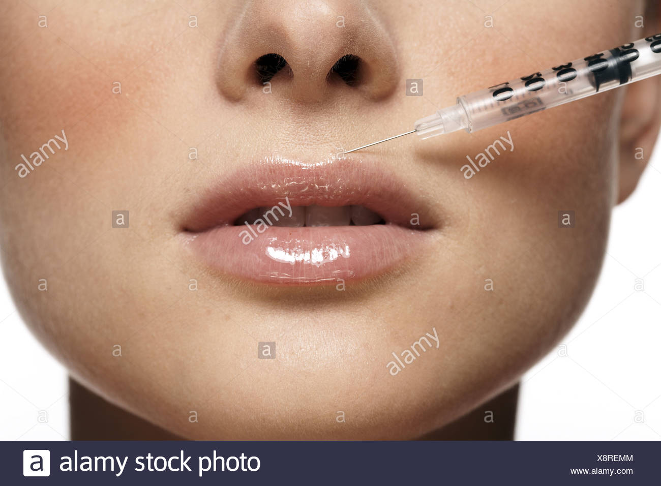Botox Needle High Resolution Stock Photography and Images Alamy