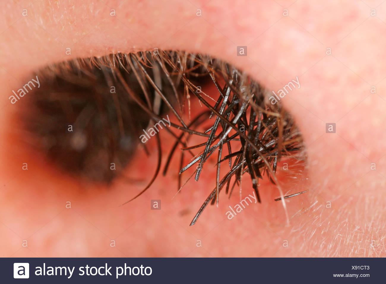 Vibrissae Hair Growing Out Of A Man S Nose Stock Photo