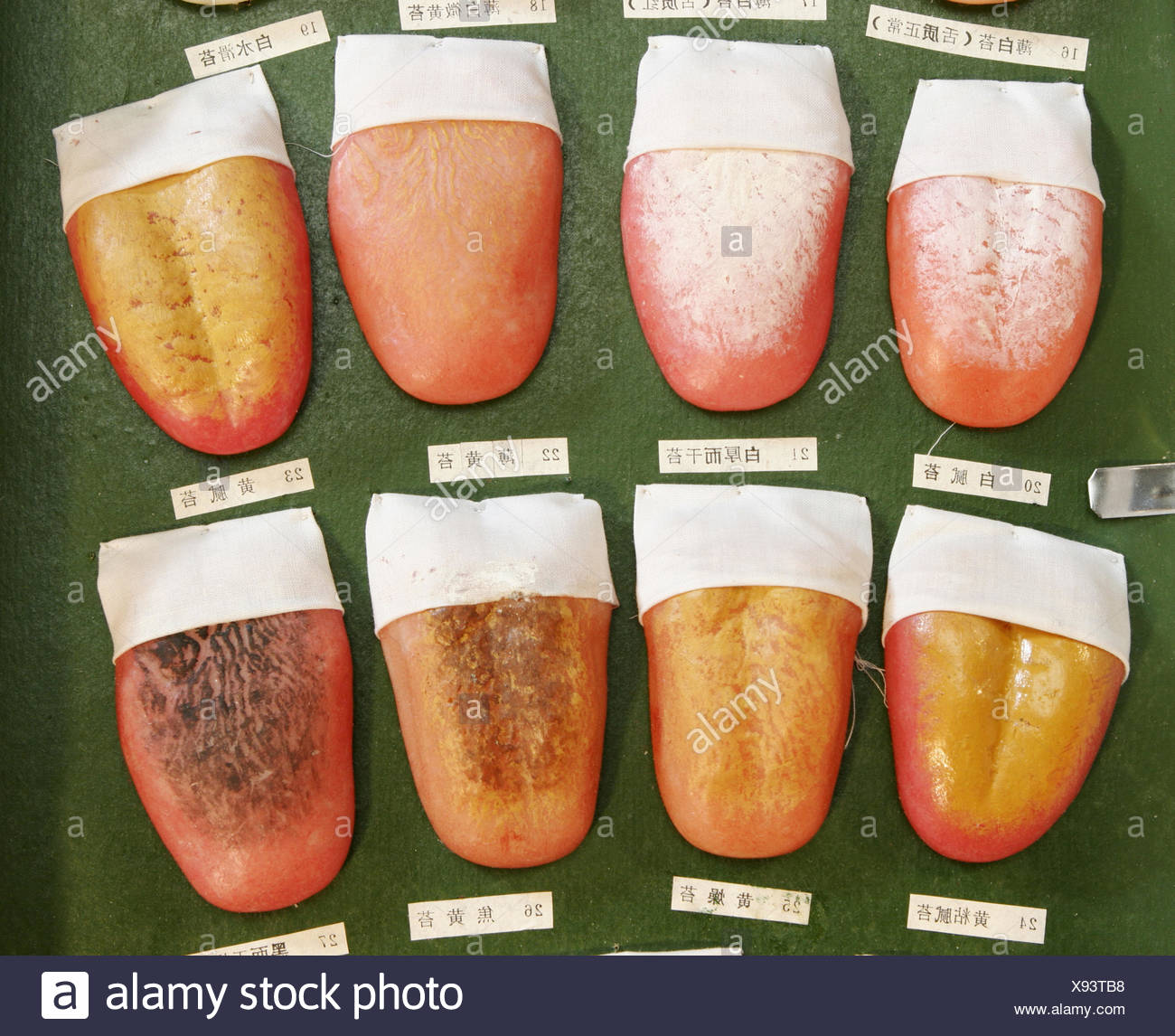 Zunge Zungenmodelle Zungendiagnose Zungendiagnostik Traditionelle Chinesische Medizin Zungenkoerper Zungenbelag Heilbehan Stock Photo Alamy