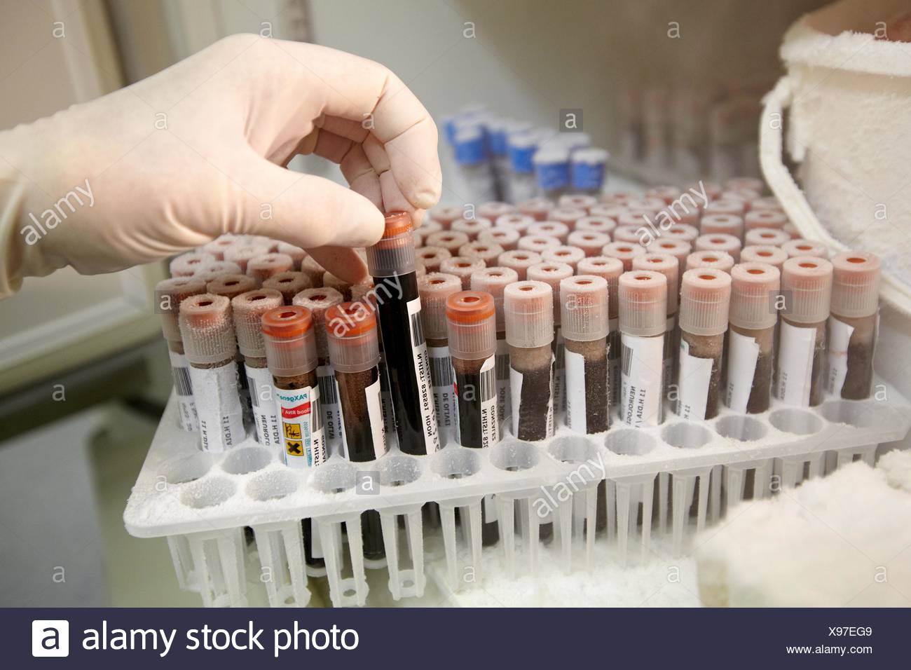 Blood Samples For Biobank High Resolution Stock Photography and Images Alamy