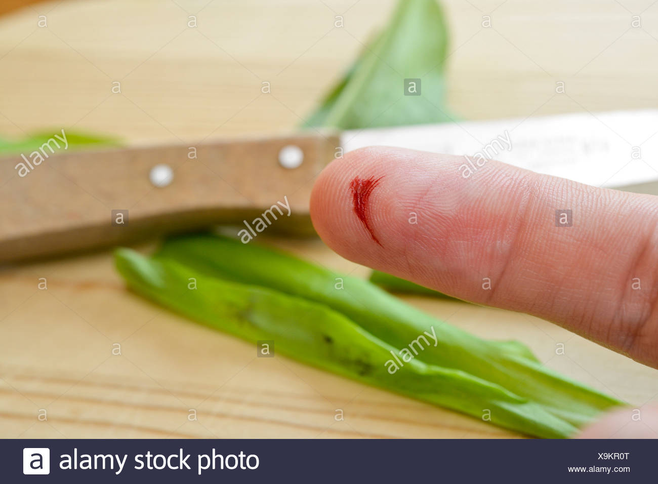 Laceration Stock Photos & Laceration Stock Images Alamy