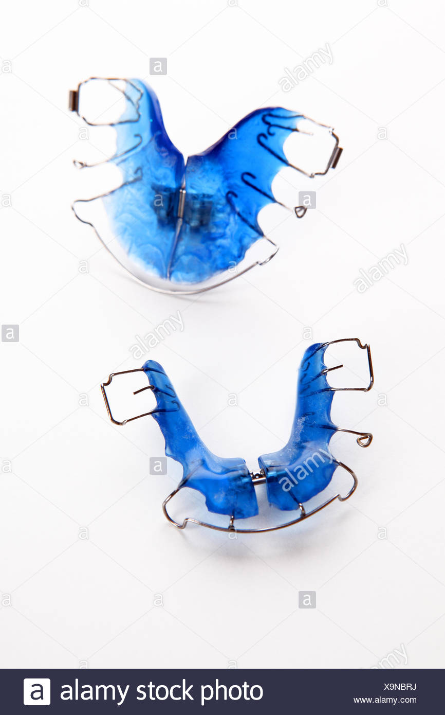 Dental brace Stock Photo