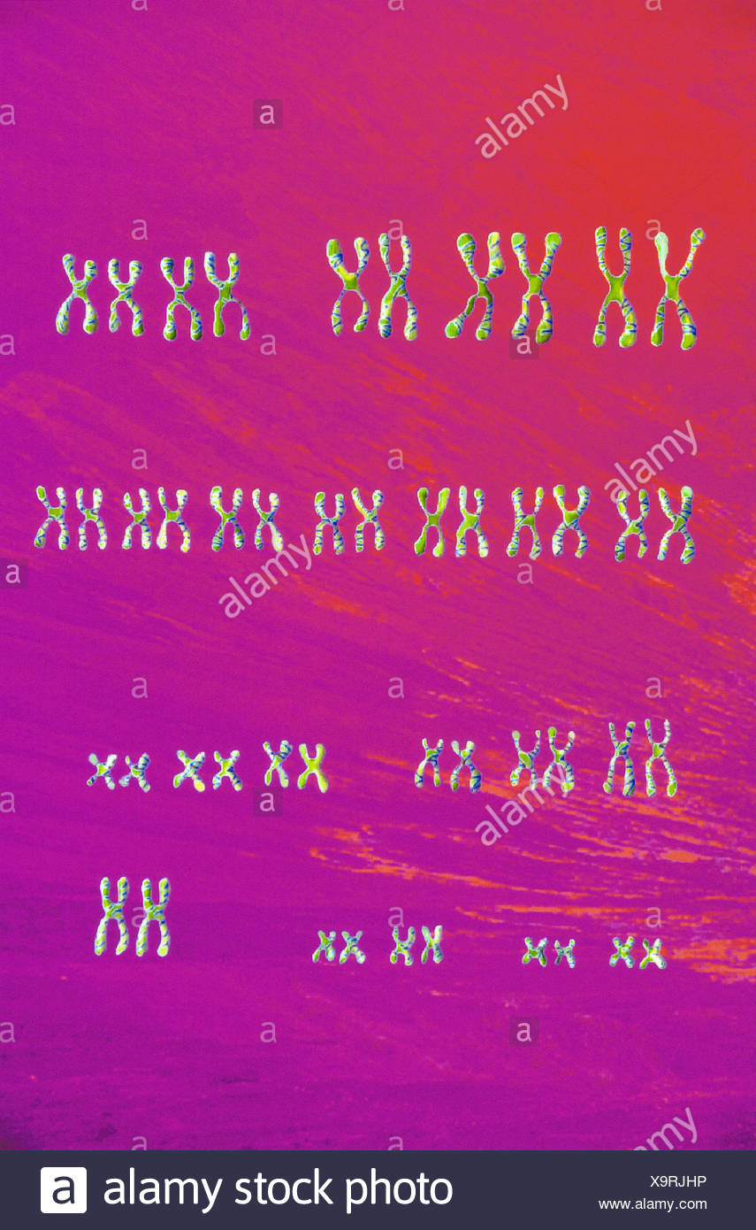 Female Caryotype High Resolution Stock Photography and Images - Alamy