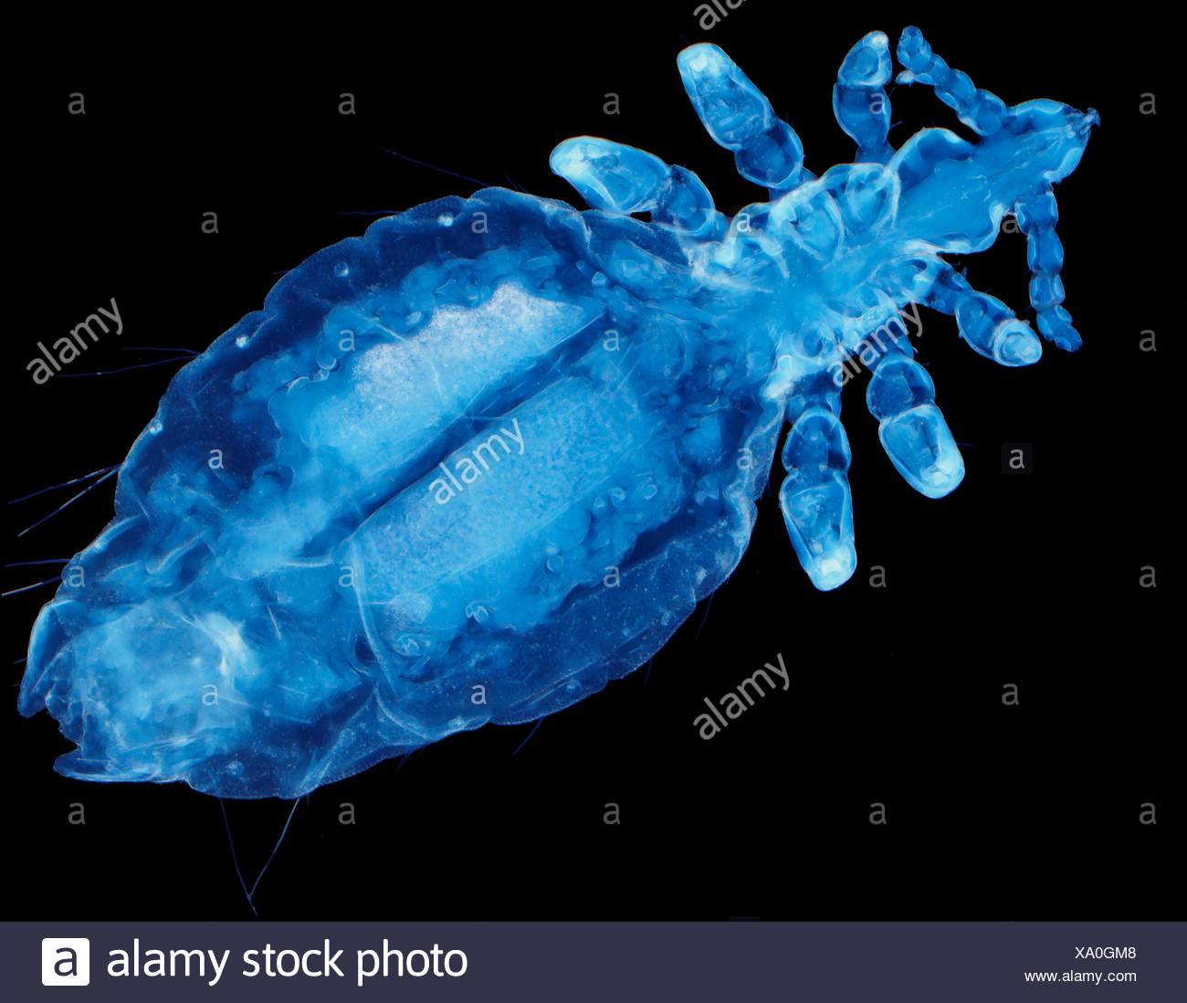 Human Head Louse Light Microraph Lm 0f Pediculus Humanus