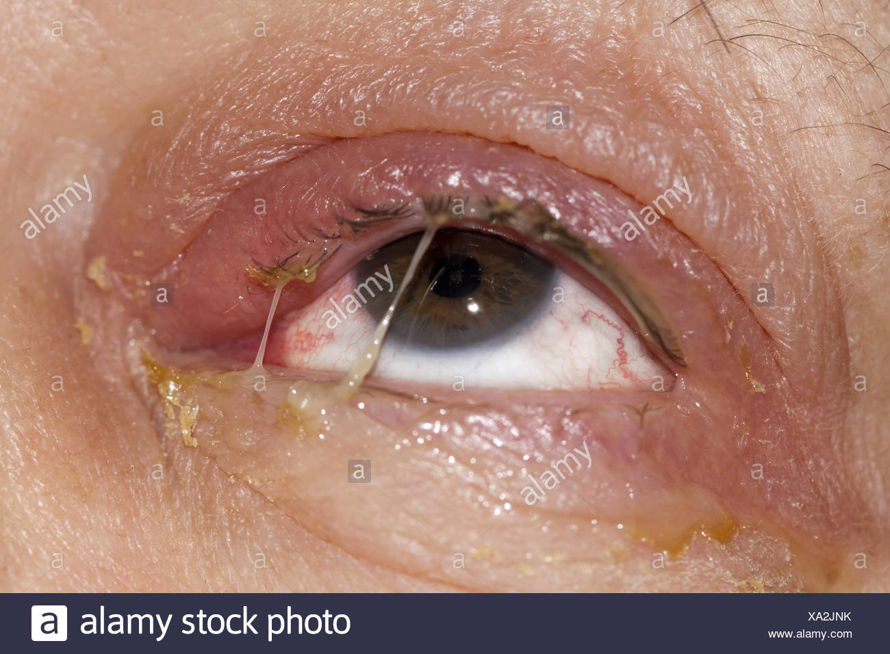 9 Best Supplements To Take During Cancer Treatment