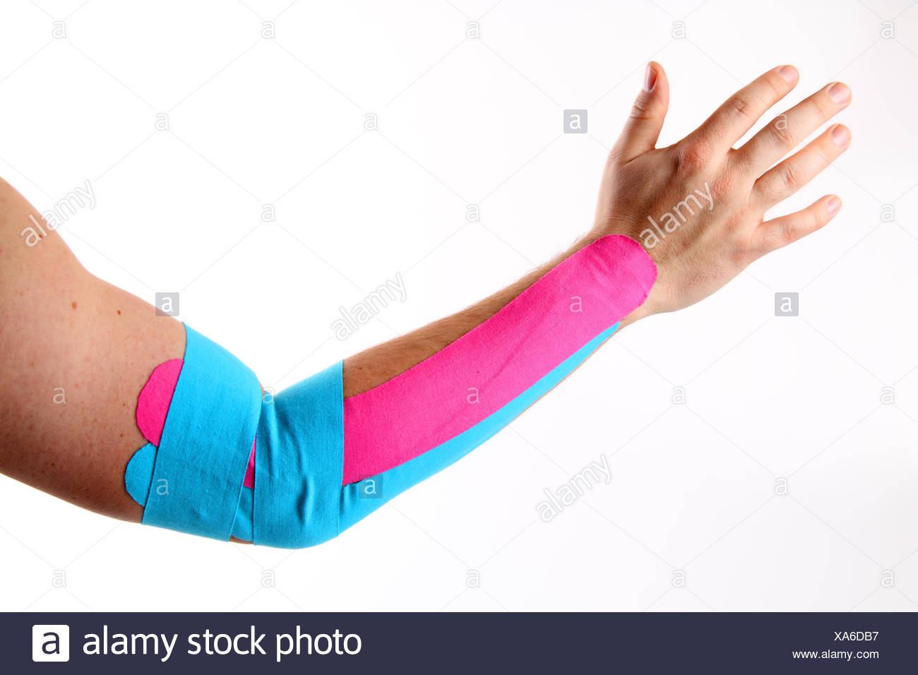 tennis elbow Stock Photo
