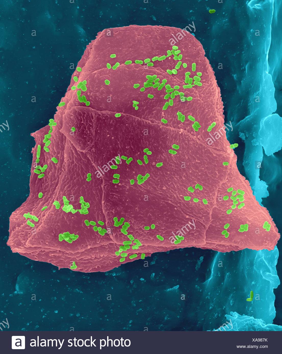 Bacterial Plaque On Teeth High Resolution Stock Photography and Images