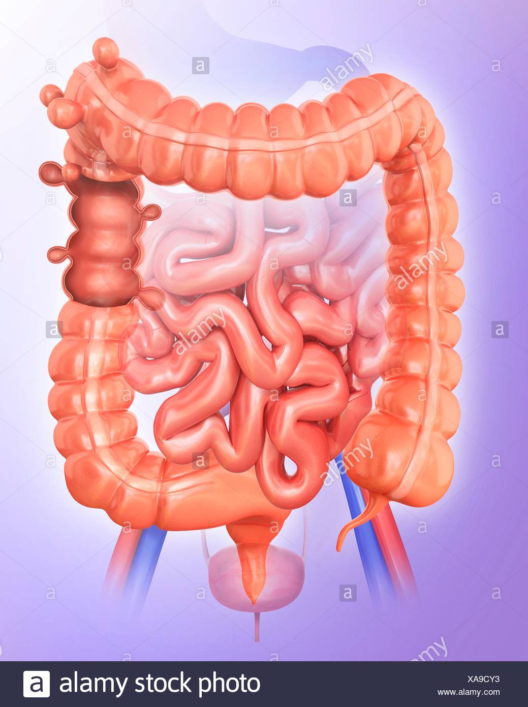 Large Intestine Diverticulitis High Resolution Stock Photography and ...