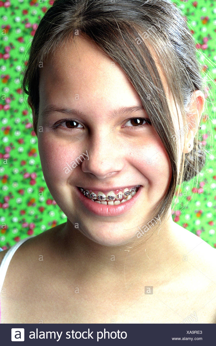 Congratulate, Young teen girls braces facial will Consider, Young teen girls braces facial recommend you