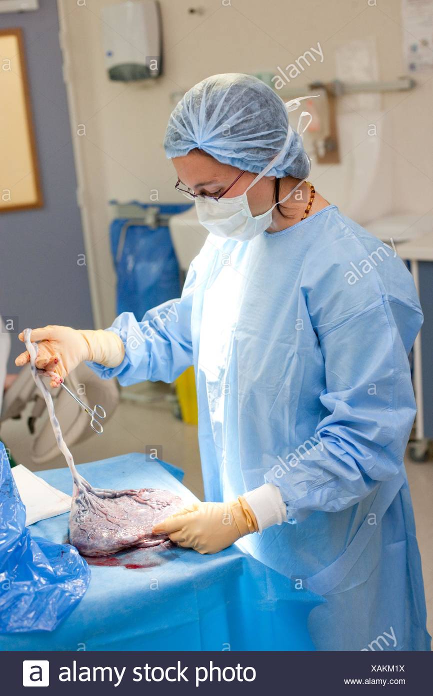 Delivery Of Placenta High Resolution Stock Photography and Images Alamy