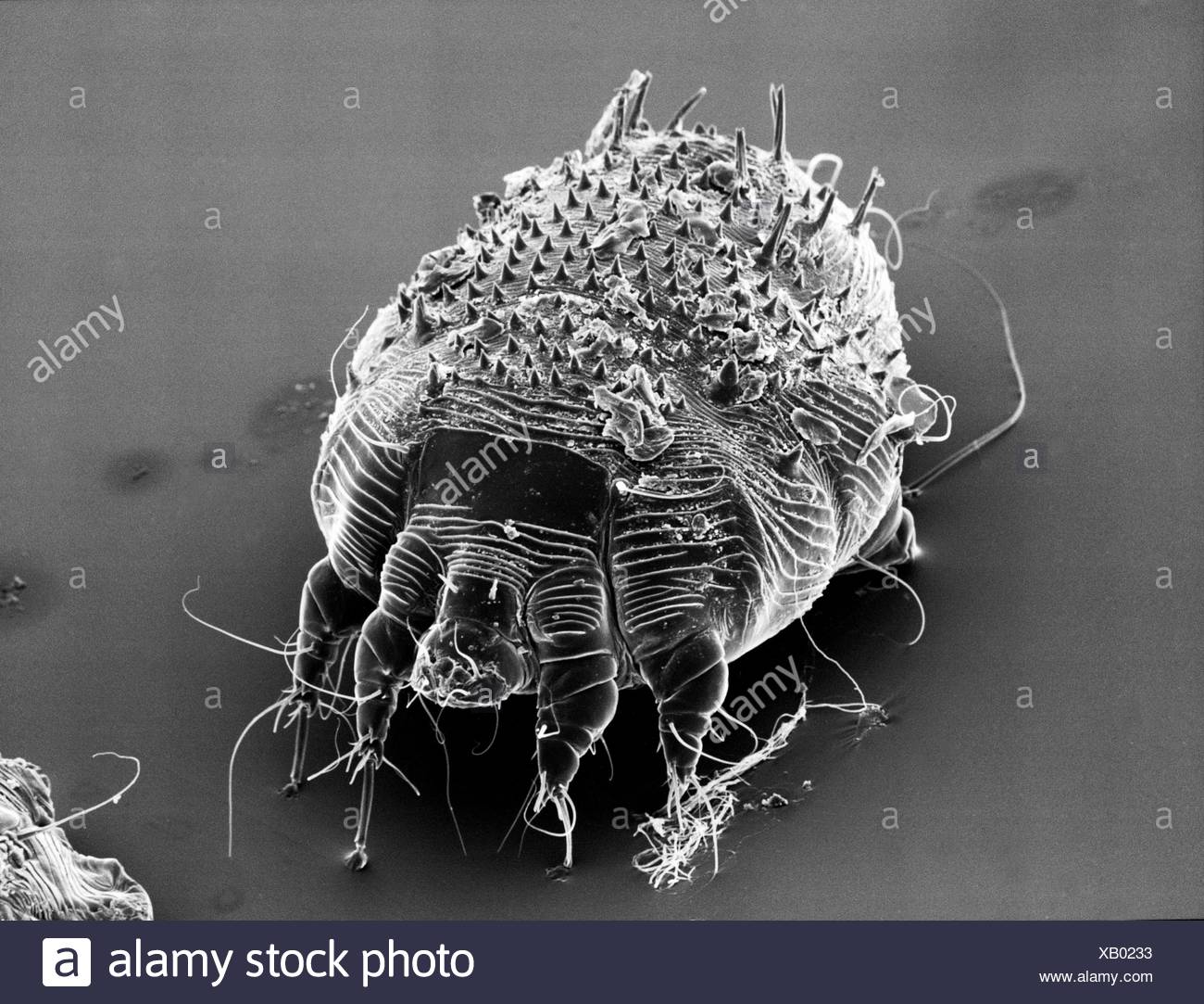 Mite Scabies Itch Photo Taken With An Electron Microscope Stock