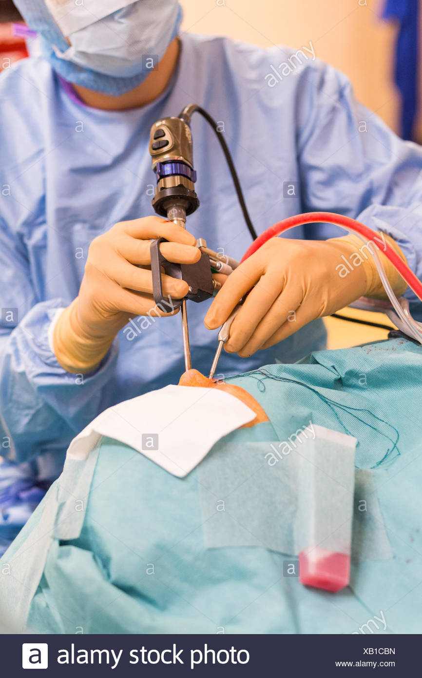 Endoscopic Stock Photos & Endoscopic Stock Images Alamy