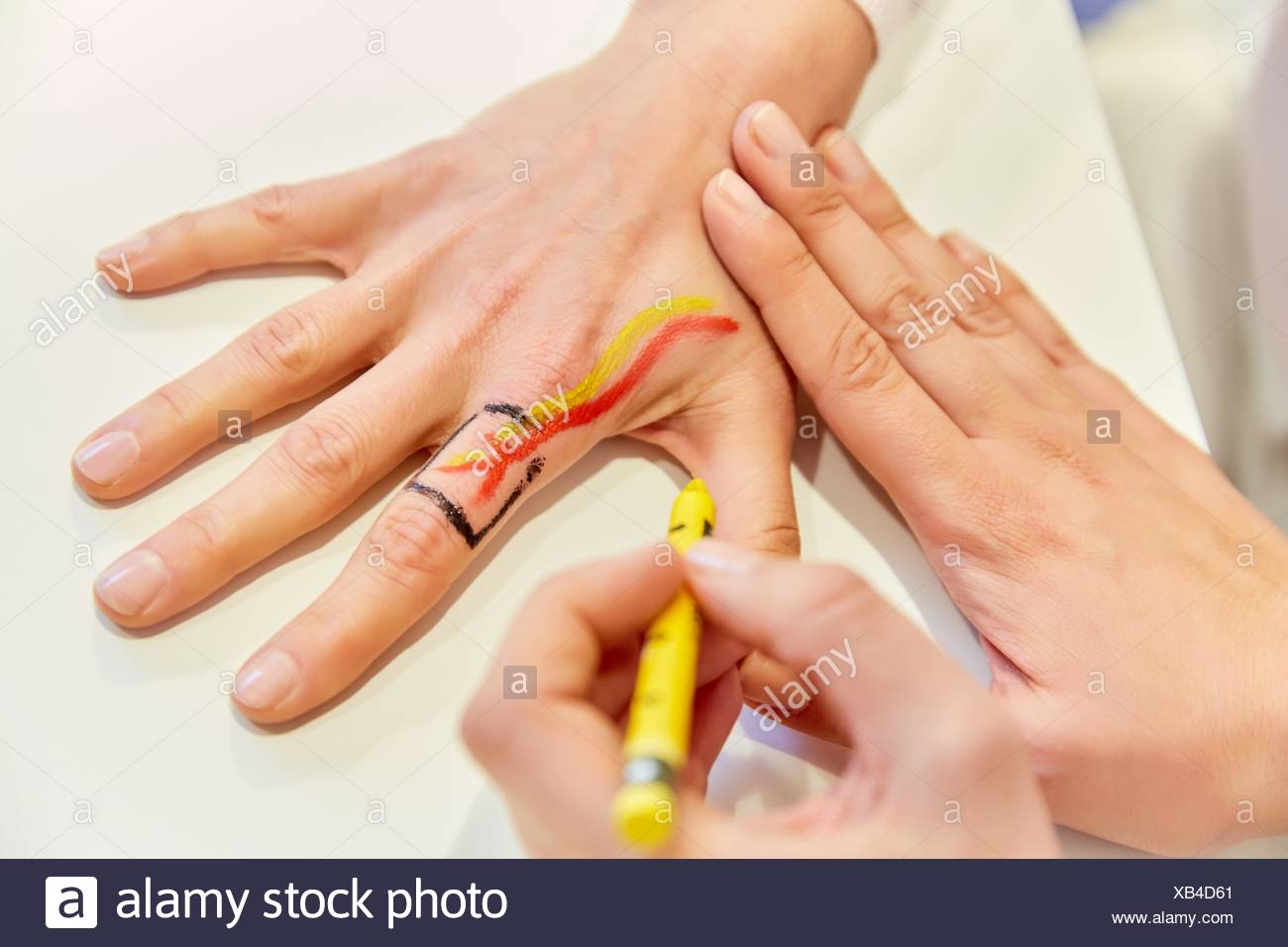 Reconstructive Surgery Stock Photos & Reconstructive Surgery Stock