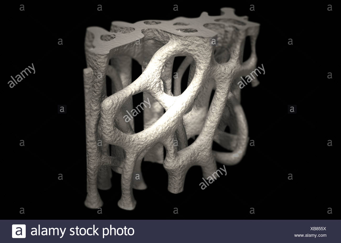 Bone Structure Osteoporosis High Resolution Stock Photography and ...
