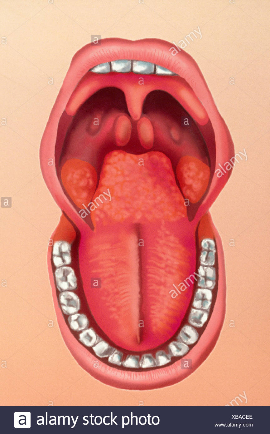 Lingual Tonsil High Resolution Stock Photography and Images Alamy
