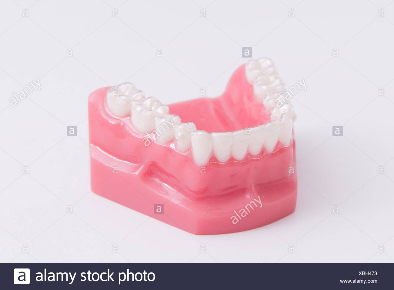 Das Unterkiefer einer Zahnprothese Stock Photo