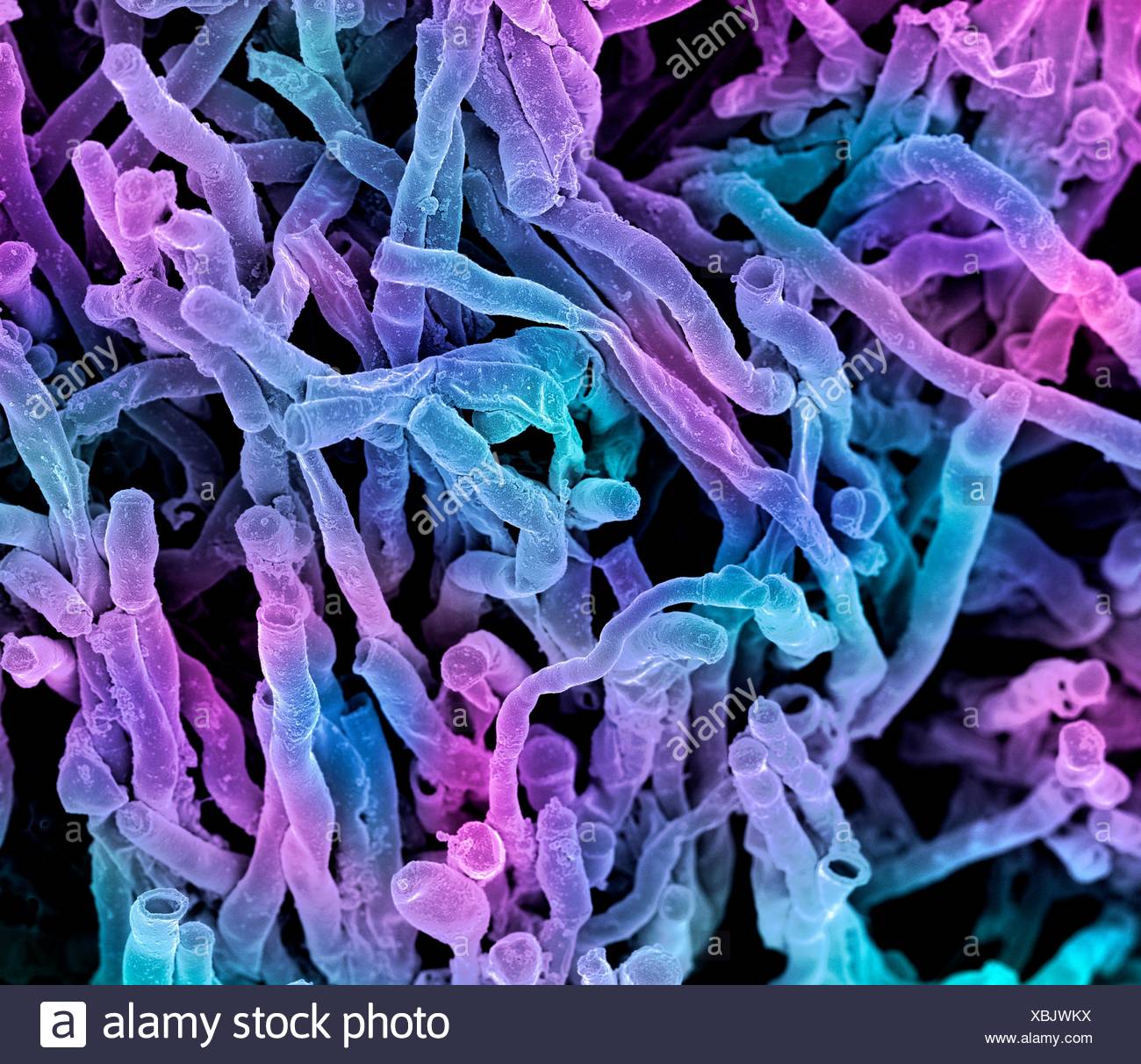 Actinomyces Viscosus Bacteria High Resolution Stock Photography and ...