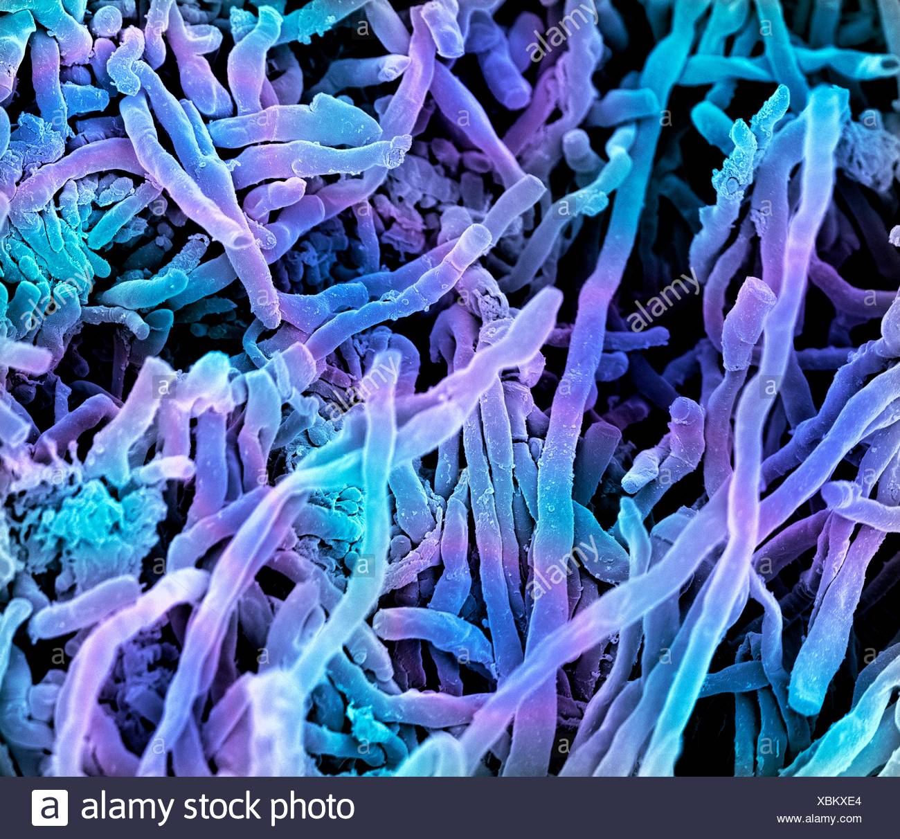 Streptomyces Stock Photos & Streptomyces Stock Images - Alamy