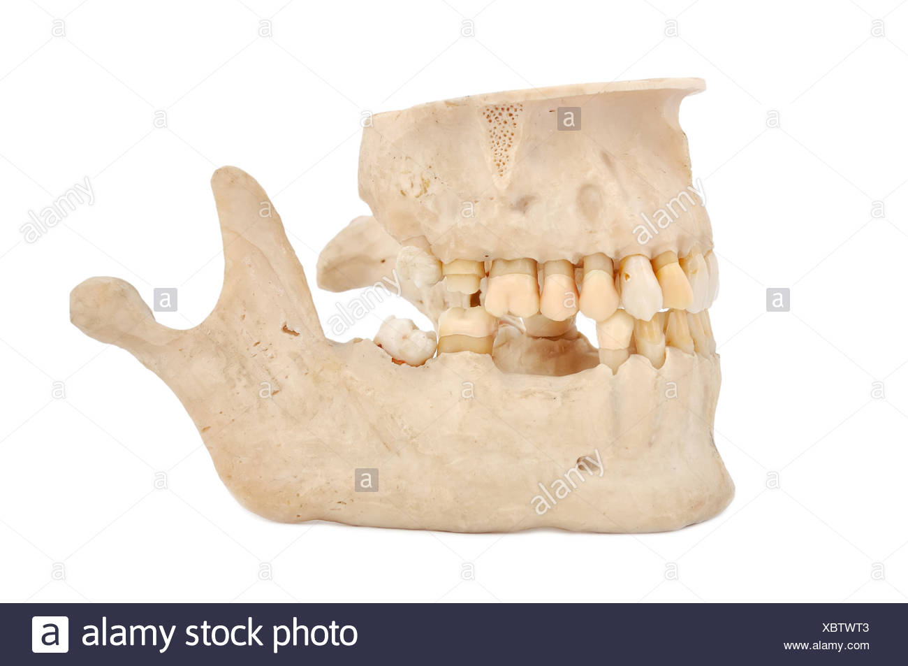 Upper Jaw Bone Cut Out Stock Images & Pictures - Alamy