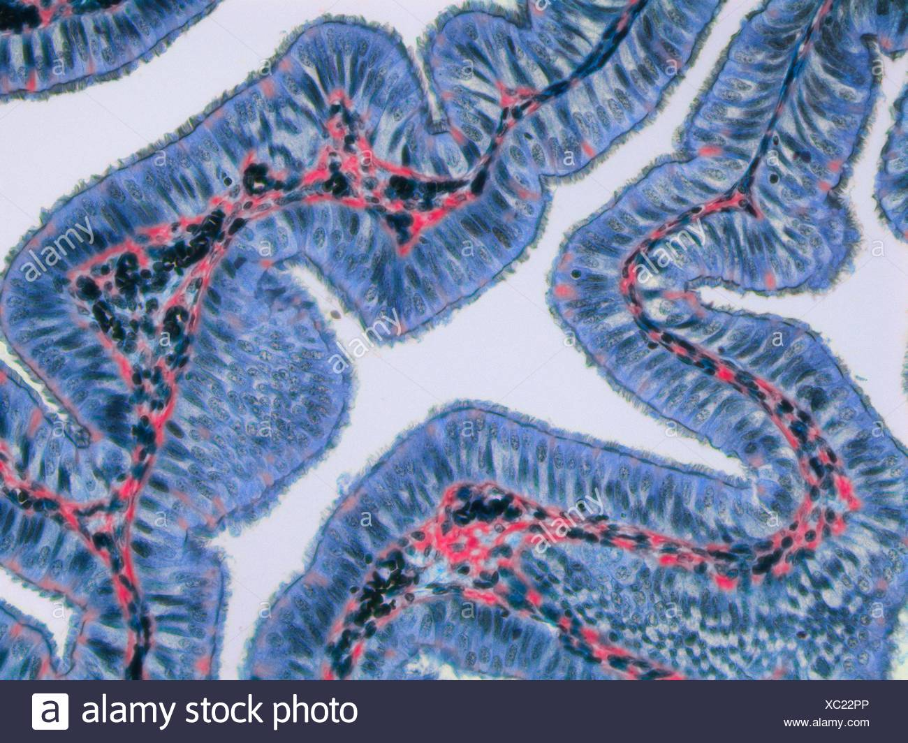 Blood Vessels Micrograph High Resolution Stock Photography and Images ...