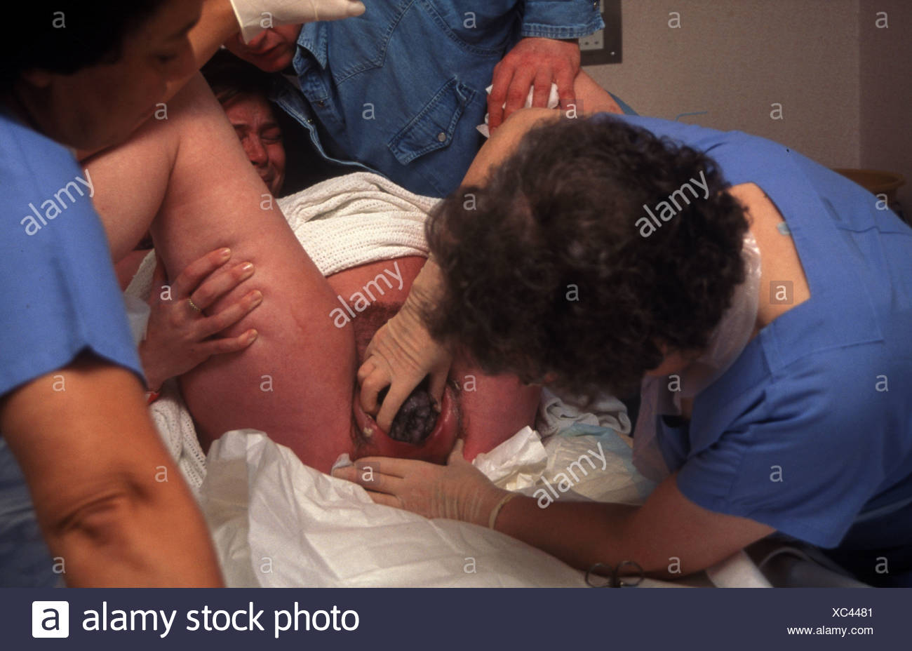 Giving Birth Crowning Pictures