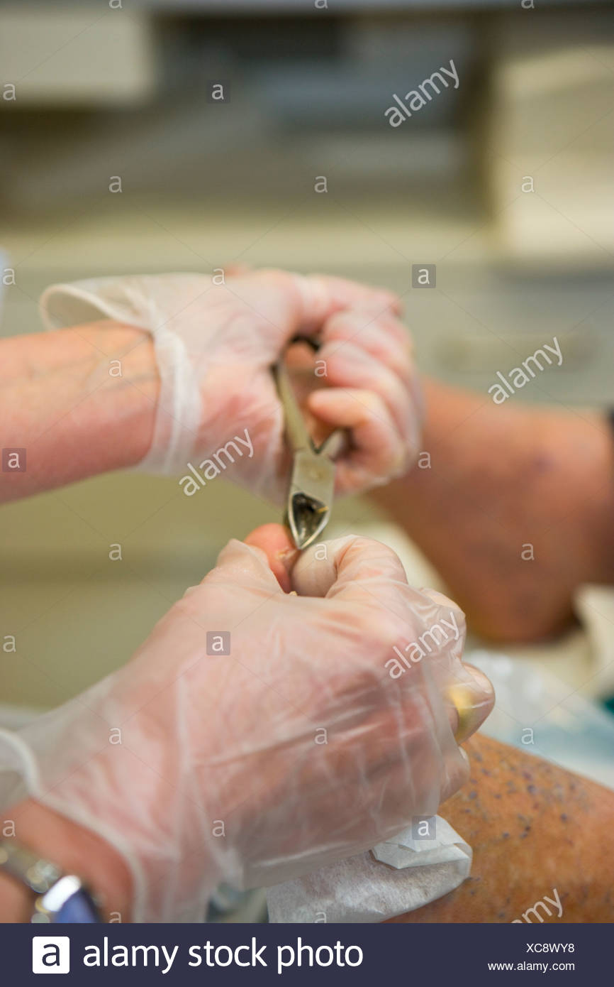 Toenails Care High Resolution Stock Photography and Images Alamy