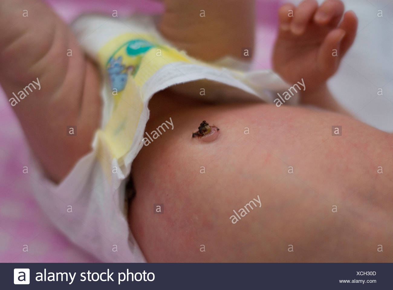 Newborn Belly Button High Resolution Stock Photography and Images Alamy