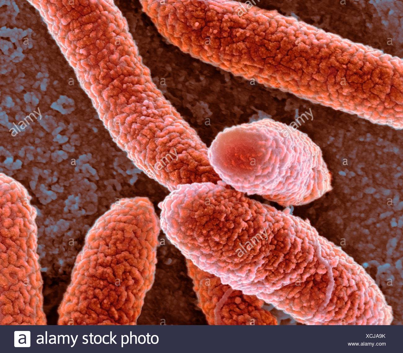 Coloured Scanning Electron Micrograph Sem Of Escherichia Coli Bacteria Magnification X27 800 When Printed At 10 Centimetres Stock Photo Alamy Coloured Scanning Electron Micrograph Sem Of Escherichia Coli Bacteria Magnification X27 800 When Printed At 10 Centimetres Stock Photo Alamy
