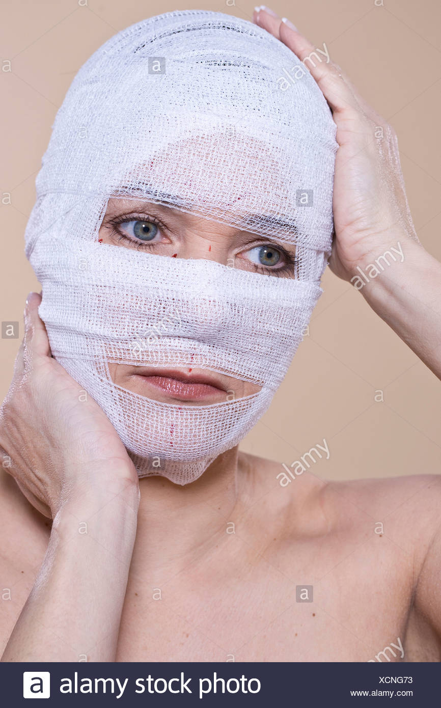 Bandaged Face High Resolution Stock Photography And Images Alamy