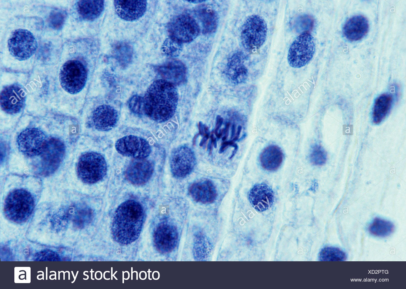Mitosis Metaphase Stock Photos & Mitosis Metaphase Stock Images Alamy
