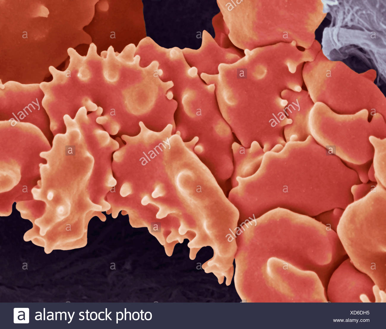 Fibrin Clot High Resolution Stock Photography and Images - Alamy