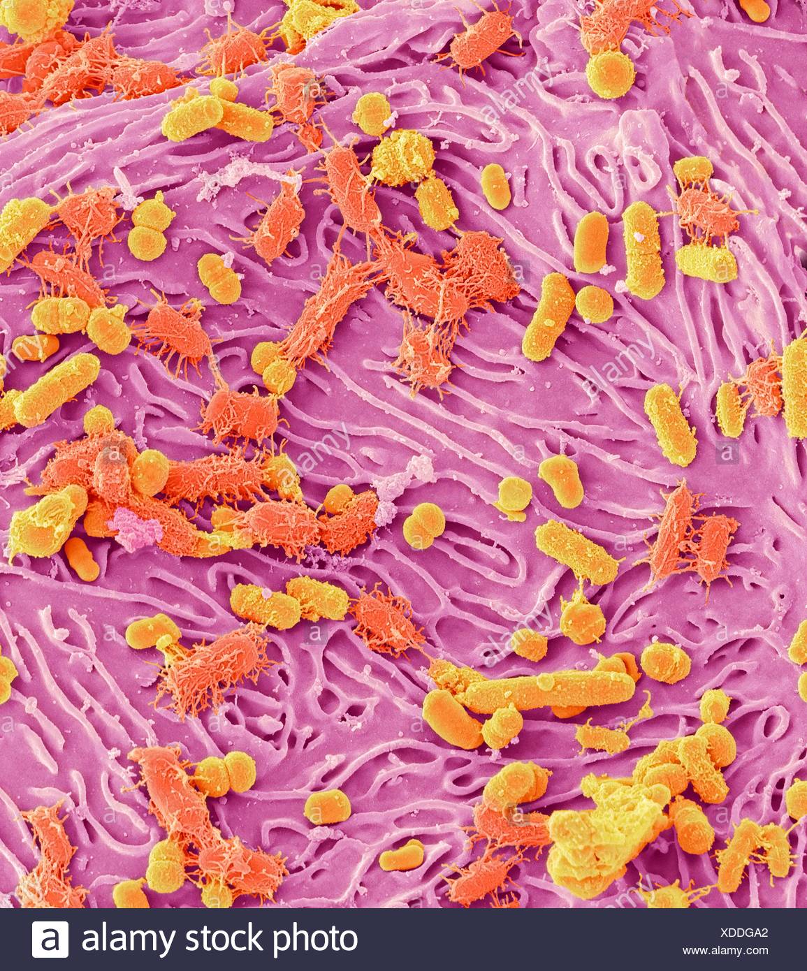 Oral Flora High Resolution Stock Photography and Images Alamy