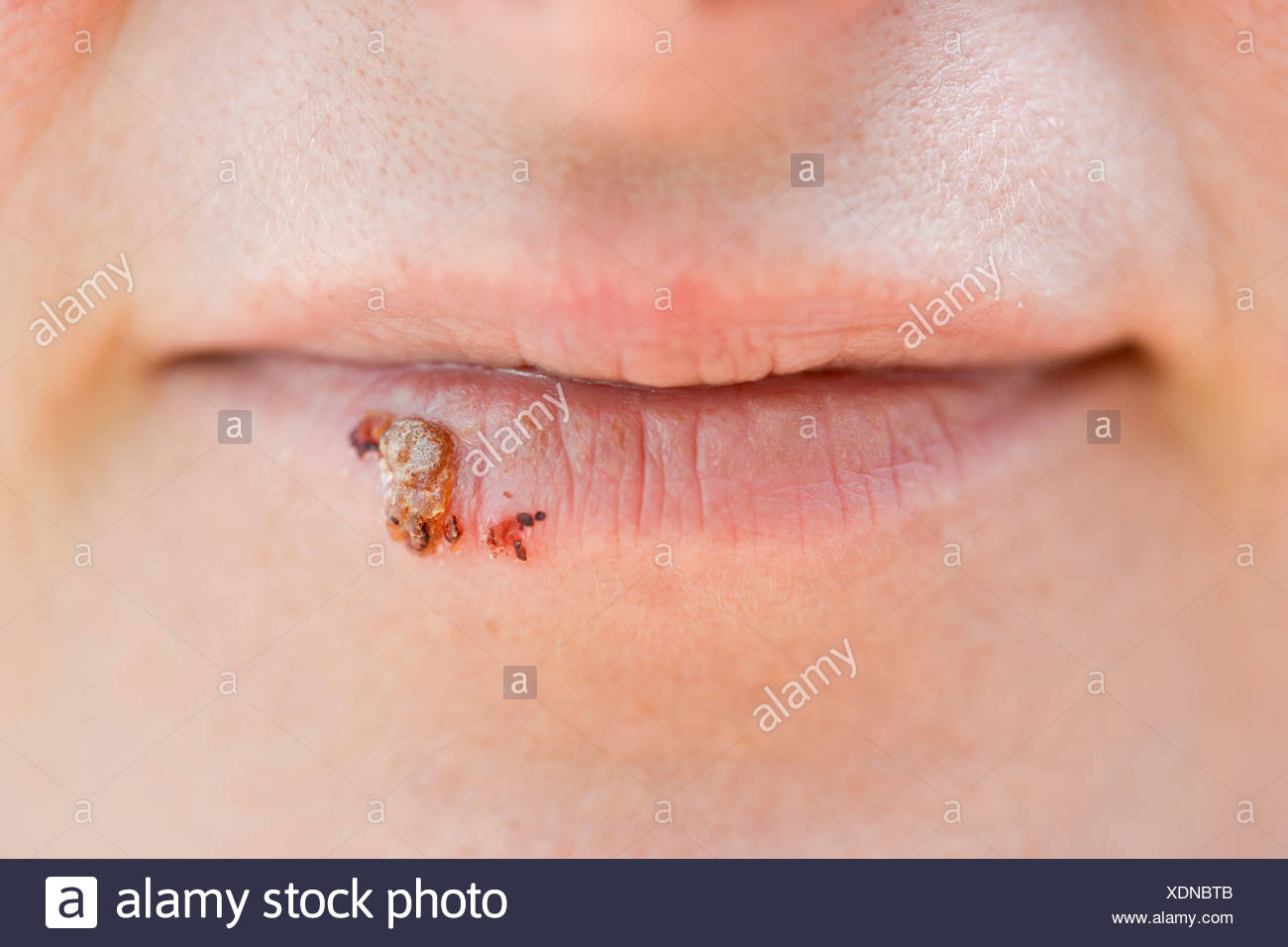 Labialis High Resolution Stock Photography and Images Alamy