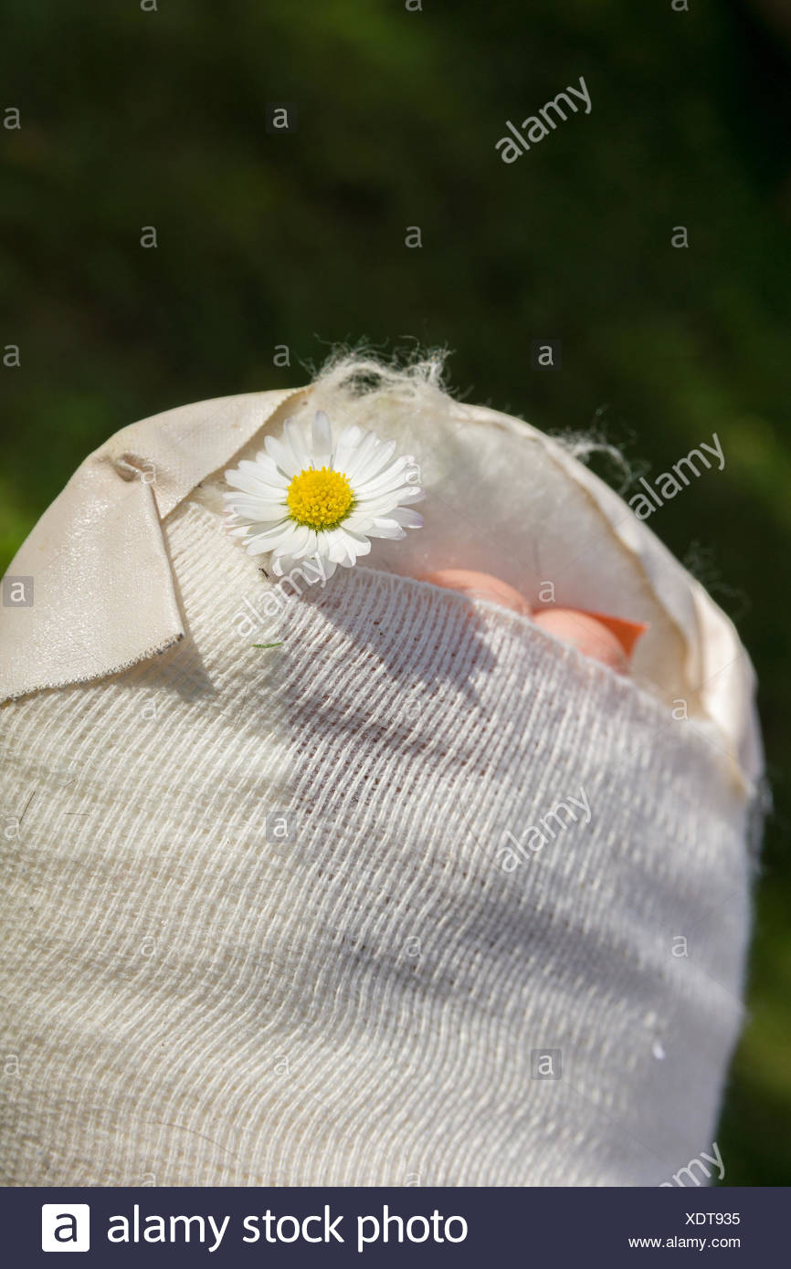 Gipsfuß eines Kindes Stock Photo