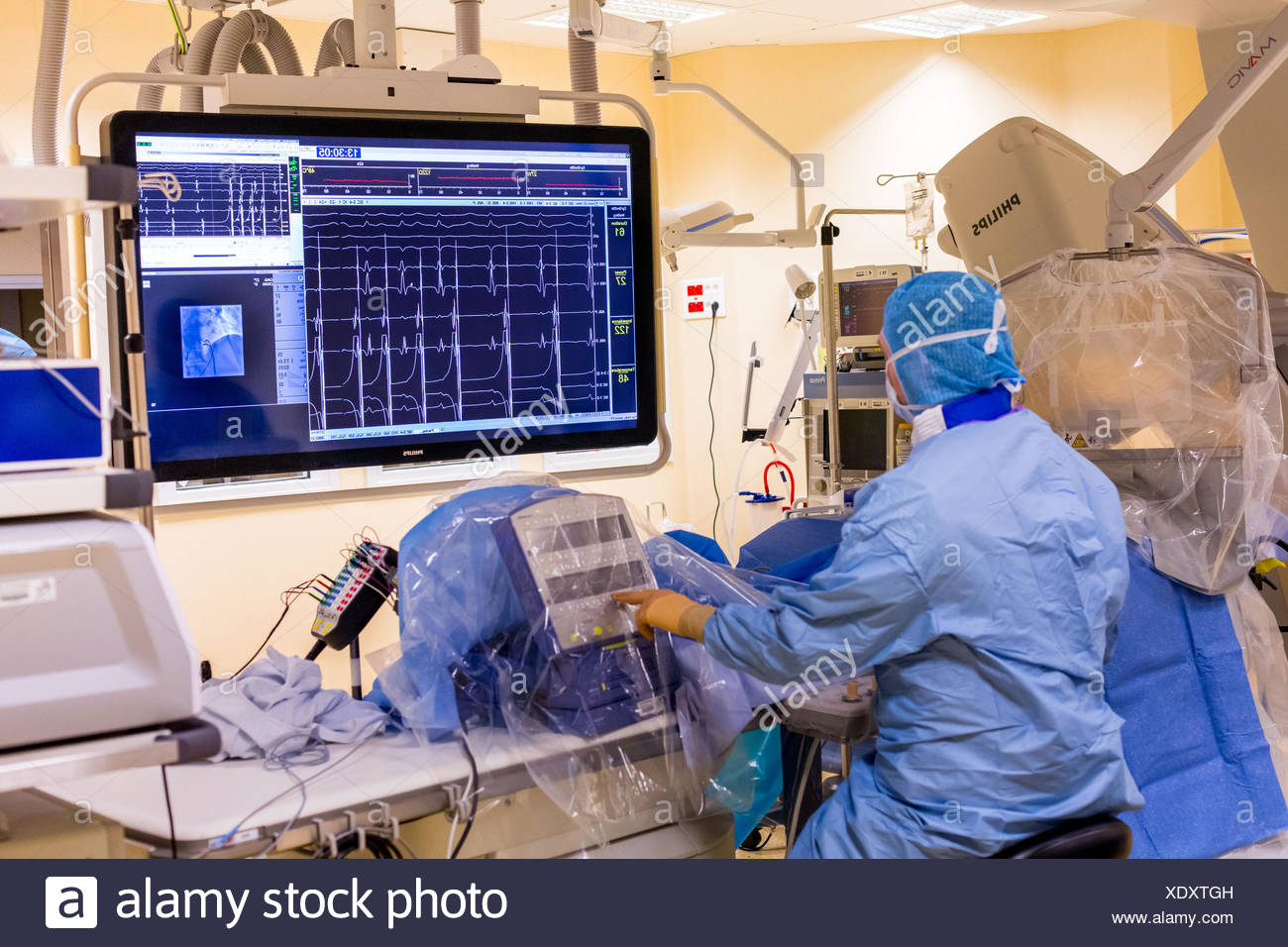 Cardiac Ablation Stock Photos & Cardiac Ablation Stock Images Alamy