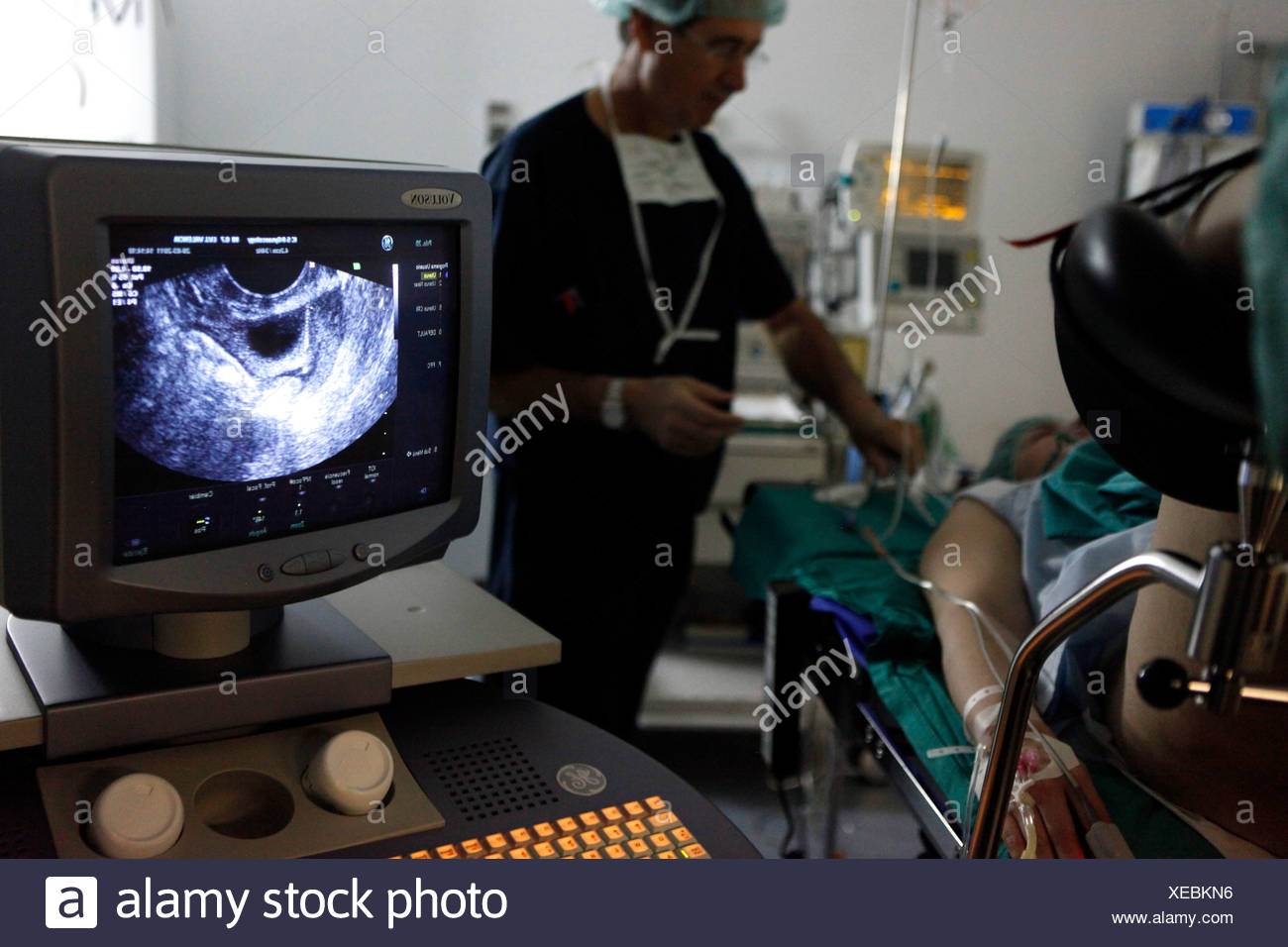 Ovarian Puncture High Resolution Stock Photography and Images Alamy