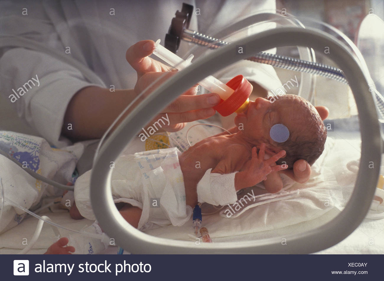feeding of premature infants