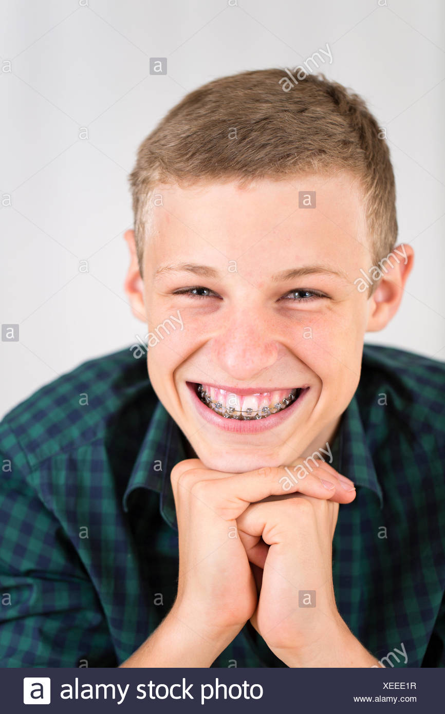 Teenager Boys Braces High Resolution Stock Photography and Images Alamy