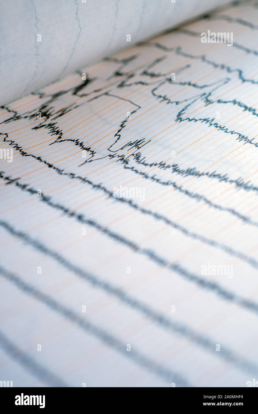 EEG-Kurve im menschlichen Gehirn, Gehirn Wellenmuster auf elektroenzephalogramm Probleme auf, die die elektrische Aktivität des Gehirns Stockfoto