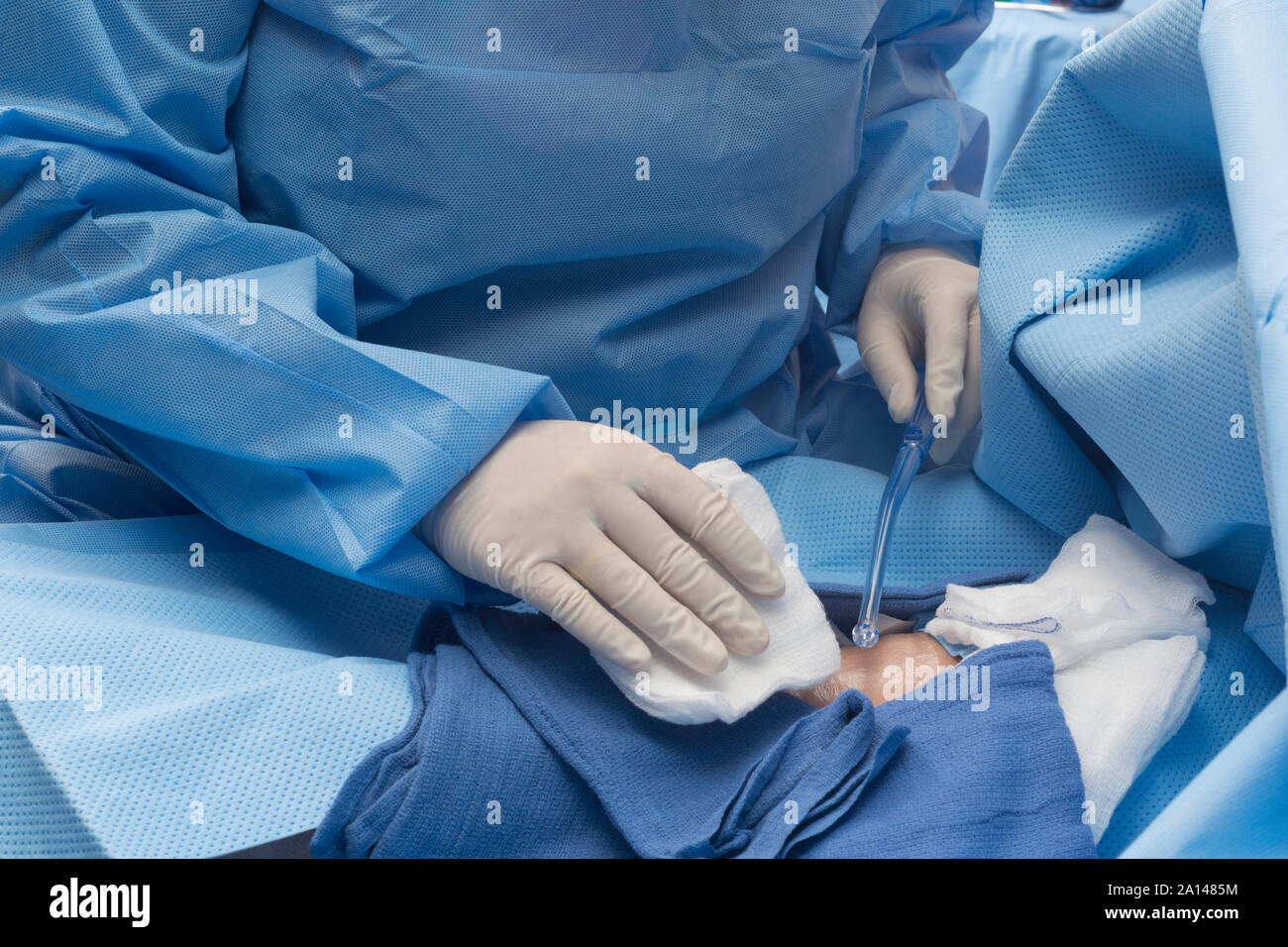 Chirurg bereitet Sog Tool im operativen Bereich zu verwenden. Stockfoto