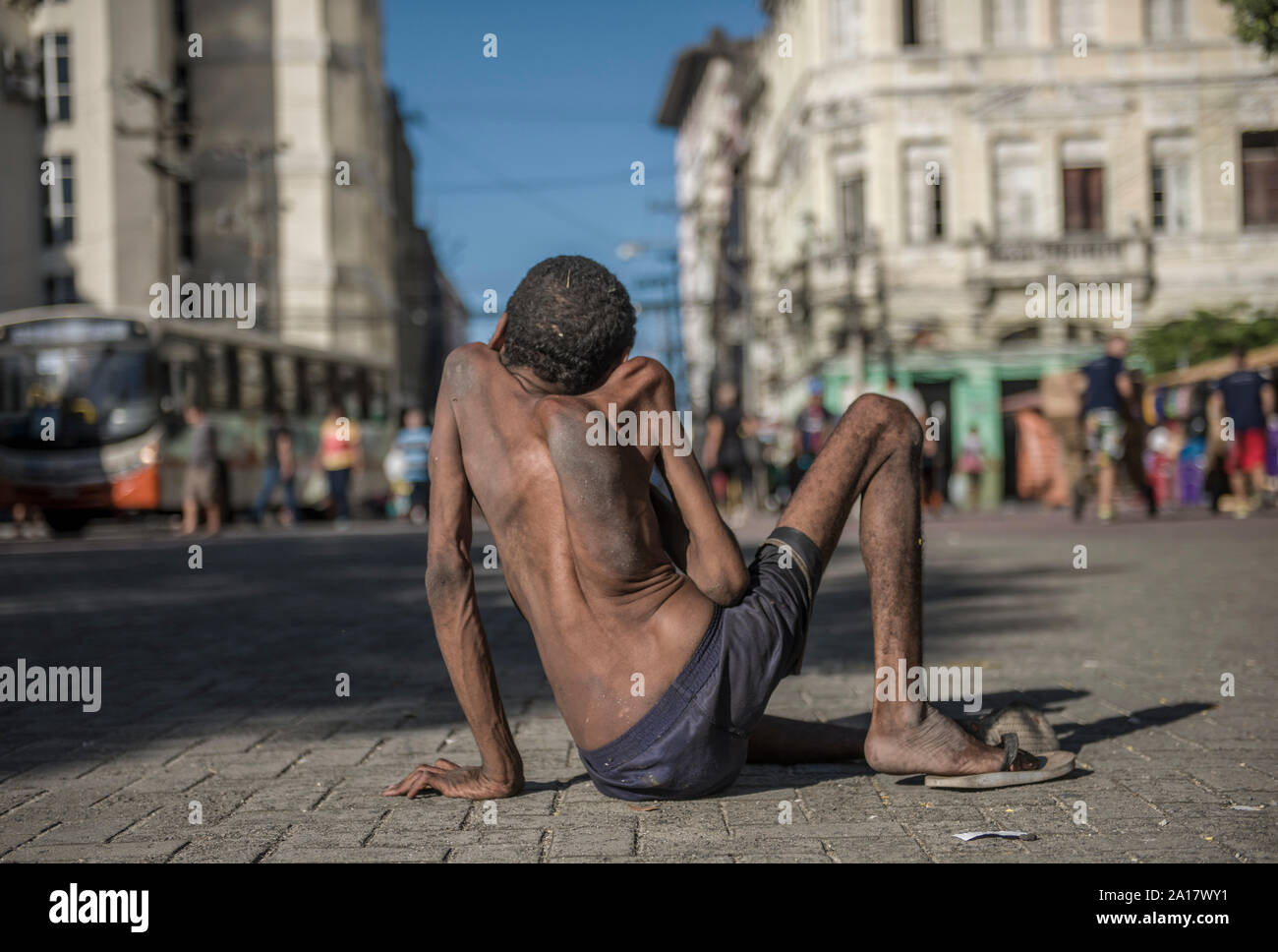 Obdachlose Menschen mit angeborenen Krankheit in Recife Downtown Stockfoto