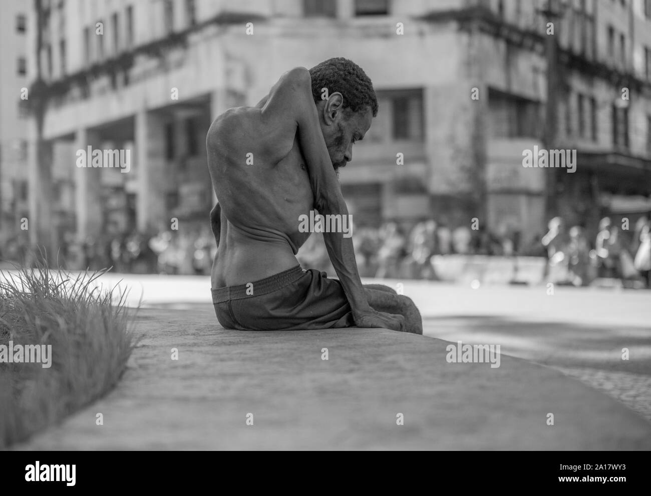 Menschen mit angeborenen Krankheit in einem Recife downtown Garten sitzen Stockfoto