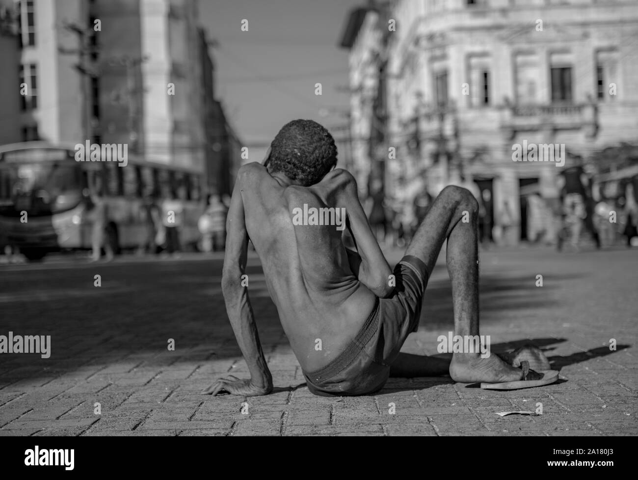Obdachlose Menschen mit angeborenen Krankheit in Recife Downtown Stockfoto