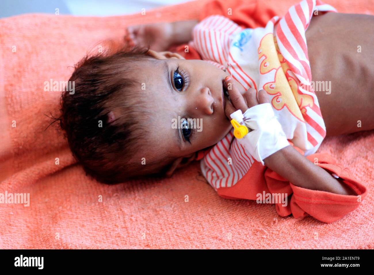 Ein JEMENITISCHES Kind an Unterernährung leiden liegt auf einem Bett bei einer Behandlung in einem Krankenhaus in der Hauptstadt Sanaa am 6. Oktober 2018. Stockfoto