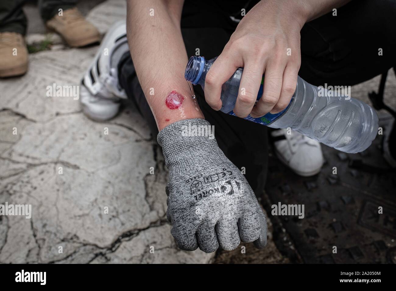 Hongkong, China. 29 Sep, 2019. Demonstrant setzt Wasser auf eine Wunde von einem Gummigeschoss während der Demonstration. Demonstranten eine Globale Anti-Totalitarianism März in Hongkong teilnehmen - Demonstrationen in Hongkong weiterhin Markieren eines der schlimmsten Tage der Gewalt in 4 Monaten der Unruhe. Credit: SOPA Images Limited/Alamy leben Nachrichten Stockfoto