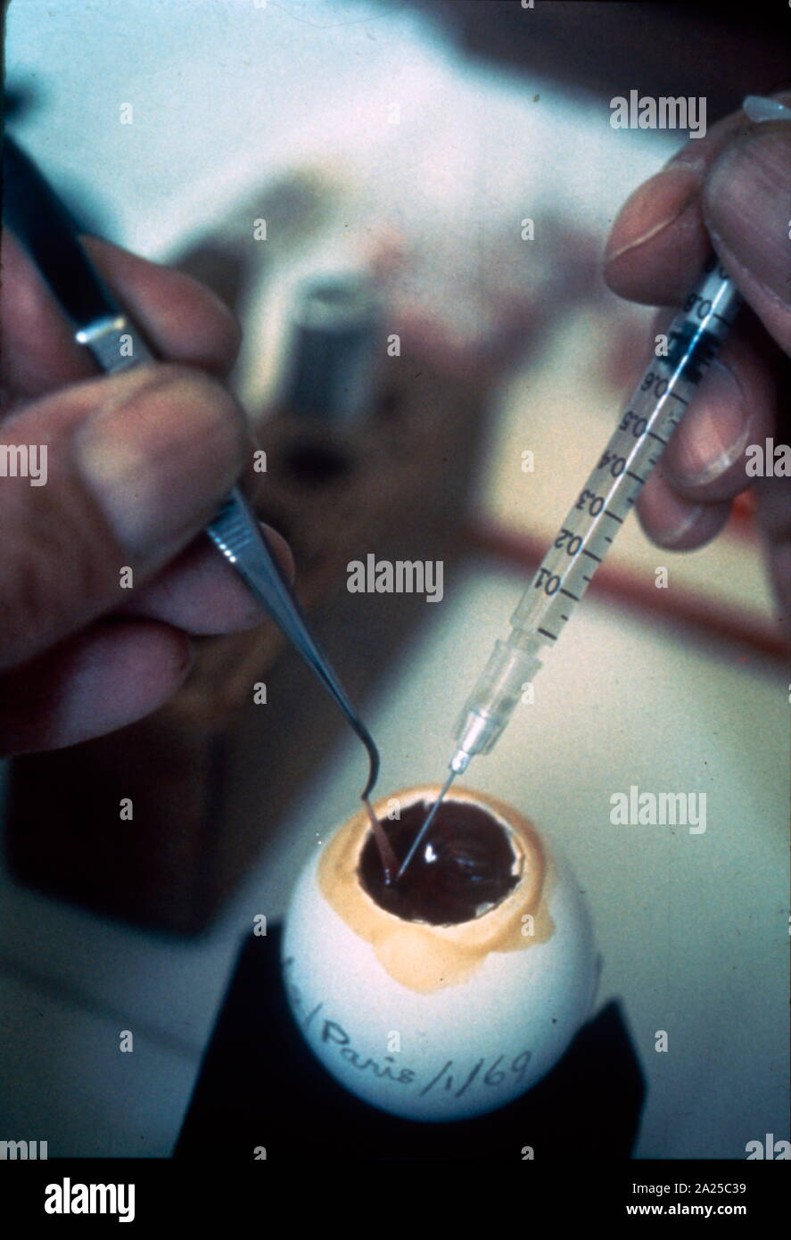Die Analyse von Influenza Virus an eine Weltgesundheitsorganisation Werk 1980 Stockfoto