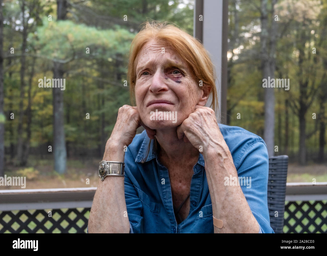 Ältere Frau mit schwarzen Auge Stockfoto