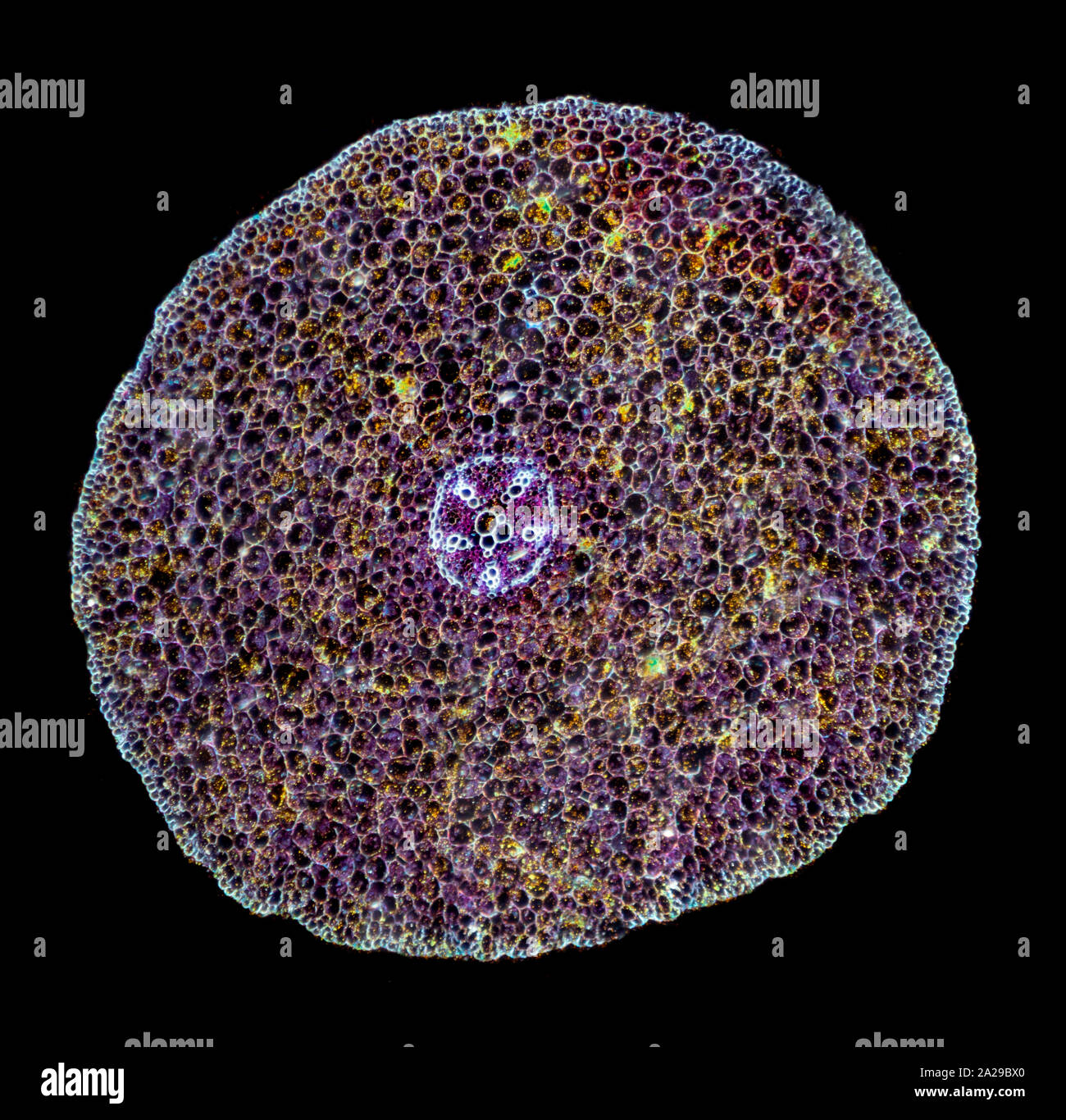 Ranunculus reife root-TS, metaxylem, Dunkelfeld photomicrograph Stockfoto