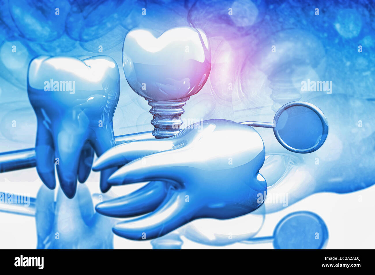 Zahnimplantate Konzept Hintergrund. 3D-Darstellung Stockfoto